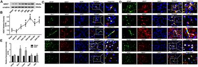 NEK7 Coordinates Rapid Neuroinflammation After Subarachnoid Hemorrhage in Mice